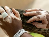 Enfermedad autoinmune: volver a escuchar al cuerpo