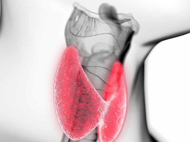 Hipotiroidismo : ¿Qué como?