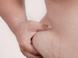 Obesidad: cambiar la relación con la comida